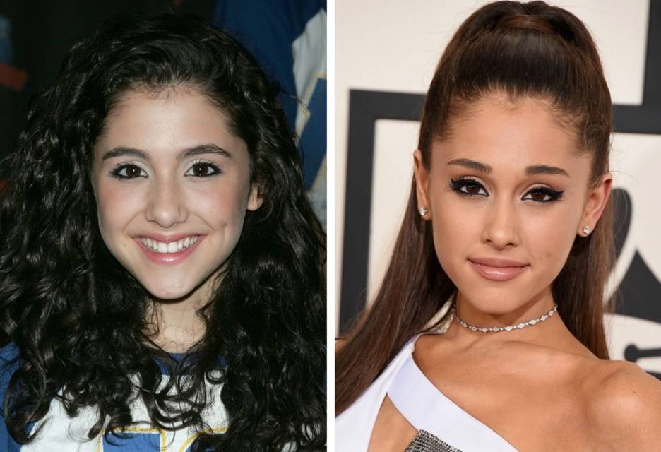 Ariana Grande’s Before and After