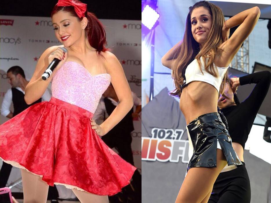 Ariana Grande S Before And After Photos Prove That She Had Plastic